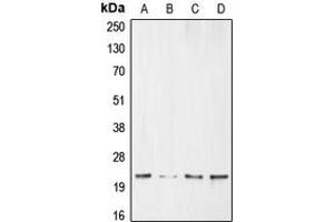 Western blot analysis of BNIP3 expression in HeLa (A), MCF7 (B), SHSY5Y (C), Ramos (D) whole cell lysates. (BNIP3 Antikörper  (Center))