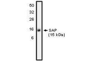 Western blot analysis using SAP antibody on NK-92 cell lysate at 10 µg/ml). (APCS Antikörper)