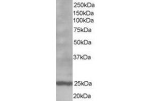 Image no. 1 for anti-B-Cell CLL/lymphoma 2 (BCL2) (N-Term) antibody (ABIN374455) (Bcl-2 Antikörper  (N-Term))