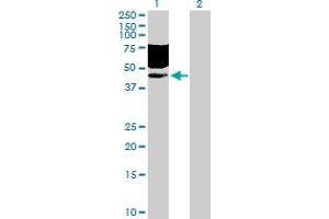 Western Blot analysis of CD96 expression in transfected 293T cell line by CD96 MaxPab polyclonal antibody. (CD96 Antikörper  (AA 1-402))