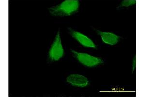 Immunofluorescence of monoclonal antibody to DIS3 on HeLa cell. (DIS3 Antikörper  (AA 861-956))