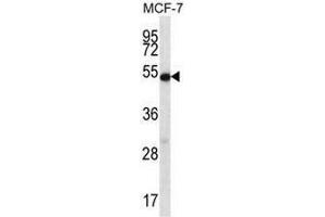 COIL Antibody (Center) western blot analysis in MCF-7 cell line lysates (35µg/lane). (Coilin Antikörper  (Middle Region))