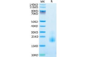 Cynomolgus TIGIT on Tris-Bis PAGE under reduced condition. (TIGIT Protein (AA 22-141) (His tag))