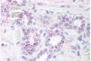 Human Kidney (formalin-fixed, paraffin-embedded) stained with RELA antibody ABIN214452 at 5 ug/ml followed by biotinylated goat anti-rabbit IgG secondary antibody ABIN481713, alkaline phosphatase-streptavidin and chromogen. (NF-kB p65 Antikörper)