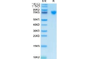 SDS-PAGE (SDS) image for Guanylate Cyclase 2C (Heat Stable Enterotoxin Receptor) (GUCY2C) (AA 24-430) protein (His tag) (ABIN7274713)