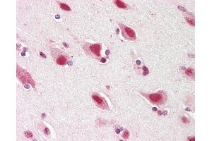 Anti-ZNF461 antibody IHC staining of human brain, cortex. (ZNF461 Antikörper  (AA 126-425))