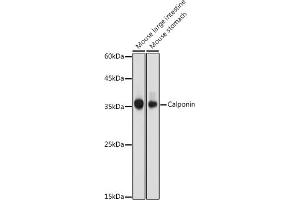 Western blot analysis of extracts of various cell lines, using Calponin antibody (ABIN7266040) at 1:1000 dilution. (CNN1 Antikörper  (AA 130-180))