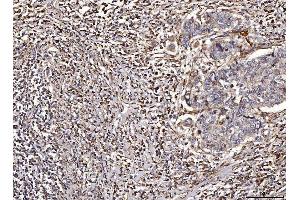 IHC analysis of ACADM/MCAD using anti-ACADM/MCAD antibody (ABIN7601543). (Medium-Chain Specific Acyl-CoA Dehydrogenase, Mitochondrial (MCAD) (AA 38-401) Antikörper)