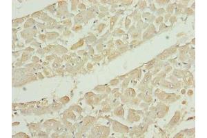 Immunohistochemistry of paraffin-embedded human heart tissue using ABIN7151945 at dilution of 1:100