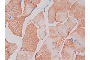 IHC-P analysis of Rat Skeletal muscle Tissue, with DAB staining. (SIGIRR Antikörper  (AA 1-118))