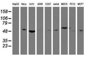 Image no. 2 for anti-Tubby Like Protein 3 (TULP3) antibody (ABIN1501586) (TULP3 Antikörper)