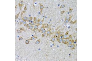 Immunohistochemistry of paraffin-embedded mouse brain using EIF2AK4 antibody. (GCN2 Antikörper)