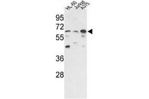 Western blot analysis of PPP3CC antibody and HL-60, Jurkat, A375 lysate. (PPP3CC Antikörper  (AA 18-47))