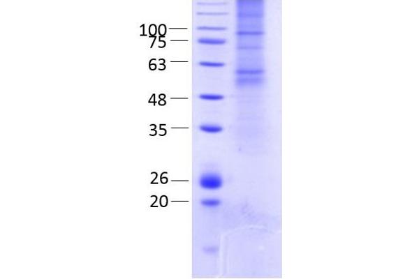 GJC2 Protein (AA 1-439) (rho-1D4 tag)
