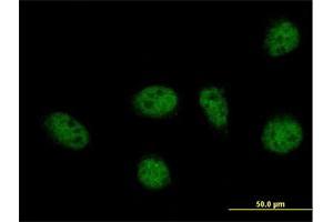 Immunofluorescence (IF) image for anti-GA Repeat Binding Protein, beta 1 (GABPB1) (AA 1-395) antibody (ABIN515891)