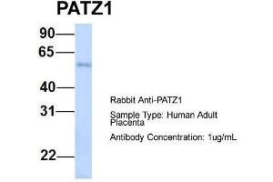 Host:  Rabbit  Target Name:  PATZ1  Sample Type:  Human Adult Placenta  Antibody Dilution:  1. (PATZ1 Antikörper  (N-Term))