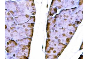 IHC analysis of Sox11 using anti-Sox11 antibody (ABIN7599308). (SOX11 Antikörper  (AA 1-358))