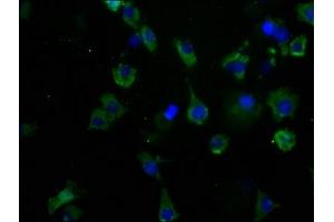 Immunofluorescence (IF) image for anti-Calcium Channel, Voltage-Dependent, N Type, alpha 1B Subunit (CACNA1B) (AA 2132-2339) antibody (ABIN7175604)