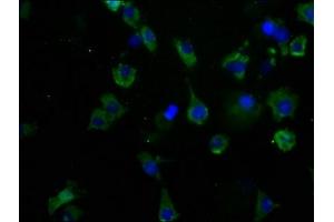 Immunofluorescence staining of SH-SY5Y cells with ABIN7175604 at 1:50, counter-stained with DAPI. (CACNA1B Antikörper  (AA 2132-2339))