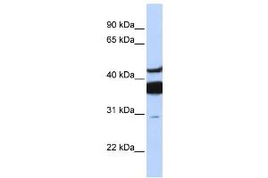 Western Blotting (WB) image for anti-Ceramide Synthase 2 (CERS2) antibody (ABIN2457964) (Ceramide Synthase 2 Antikörper)
