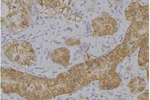 ABIN6273644 at 1/100 staining Human uterus tissue by IHC-P. (IFNA2 Antikörper  (N-Term))