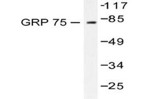 Image no. 1 for anti-Heat Shock 70kDa Protein 9 (Mortalin) (HSPA9) antibody (ABIN265446) (HSPA9 Antikörper)