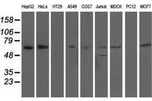 Western blot analysis of extracts (35 µg) from 9 different cell lines by using anti-AFP monoclonal antibody. (alpha Fetoprotein Antikörper)