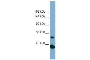 Host:  Rabbit  Target Name:  RAD50  Sample Type:  PANC1 Whole Cell lysates  Antibody Dilution:  1.
