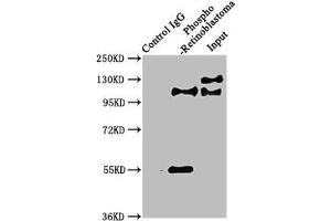 Immunoprecipitating Phospho-RB1 in Hela whole cell lysate Lane 1: Rabbit control IgG(1 μg)instead of ABIN7127740 in Hela whole cell lysate. (Rekombinanter Retinoblastoma 1 Antikörper  (pSer780))