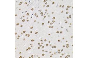 Immunohistochemistry (IHC) image for anti-SWI/SNF Related, Matrix Associated, Actin Dependent Regulator of Chromatin, Subfamily D, Member 1 (SMARCD1) (AA 1-120) antibody (ABIN6137420)