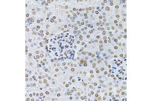 Immunohistochemistry (Paraffin-embedded Sections) (IHC (p)) image for anti-Integrin-Linked Kinase (ILK) (AA 1-260) antibody (ABIN3021145)
