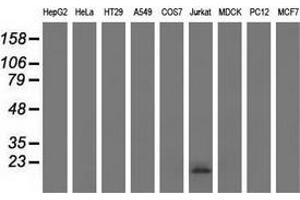 Western blot analysis of extracts (35 µg) from 9 different cell lines by using anti-EFNA2 monoclonal antibody. (Ephrin A2 Antikörper)