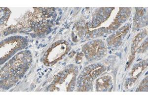 ABIN6277635 at 1/100 staining Human prostate tissue by IHC-P. (PNMT Antikörper  (N-Term))