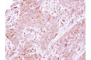 Immunohistochemistry (IHC) image for anti-Lactate Dehydrogenase A (LDHA) antibody (ABIN2855034)