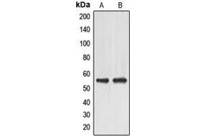Western blot analysis of EMR4 expression in HeLa (A), HuvEc (B) whole cell lysates. (EMR4 Antikörper  (Center))