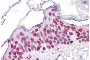 Human Skin: Formalin-Fixed, Paraffin-Embedded (FFPE) (SIRT1 Antikörper  (AA 456-555))