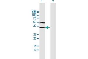 Western Blot analysis of ACRV1 expression in transfected 293T cell line by ACRV1 MaxPab polyclonal antibody. (ACRV1 Antikörper  (AA 1-265))