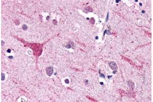 Immunohistochemical (Formalin/PFA-fixed paraffin-embedded sections) staining in human brain, neurons and glia with NPFFR2 polyclonal antibody . (NPFFR2 Antikörper  (3rd Extracellular Domain))