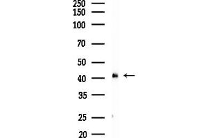 anti-Hydroxy-delta-5-Steroid Dehydrogenase, 3 beta- and Steroid delta-Isomerase 2 (HSD3B2) antibody
