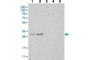 Western blot analysis of Lane 1: RT-4, Lane 2: U-251 MG, Lane 3: Human Plasma, Lane 4: Liver, Lane 5: Tonsil with LOC153364 polyclonal antibody  at 1:250-1:500 dilution. (MBLAC2 Antikörper)