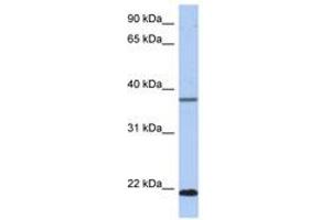 Image no. 1 for anti-HD Domain Containing 3 (HDDC3) (C-Term) antibody (ABIN6743918) (HDDC3 Antikörper  (C-Term))