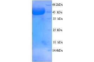 SDS-PAGE (SDS) image for Myosin Binding Protein C, Fast Type (MYBPC2) (AA 739-1141), (partial) protein (His tag) (ABIN5714324)