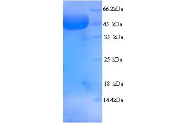 MYBPC2 Protein (AA 739-1141, partial) (His tag)
