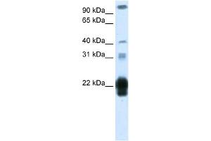 WB Suggested Anti-CSH1 Antibody Titration:  1. (CSH1 Antikörper  (Middle Region))