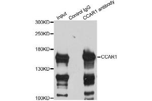 Immunoprecipitation analysis of 200ug extracts of HeLa cells using 3ug CCAR1 antibody (ABIN6291285). (CCAR1 Antikörper)