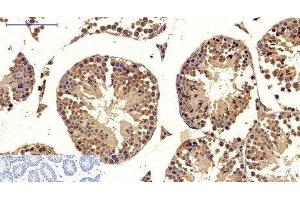 Immunohistochemistry of paraffin-embedded Mouse testis tissue using MICU1 Monoclonal Antibody at dilution of 1:200. (MICU1 Antikörper)