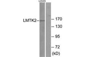 Western blot analysis of extracts from LOVO cells, using LMTK2 Antibody. (LMTK2 Antikörper  (AA 651-700))