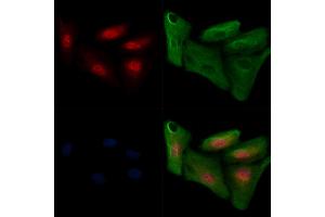 ABIN6255286 and ABIN6267647 staining  cells(H2O2 treatment) by IF/ICC. (IRF3 Antikörper  (pSer386))