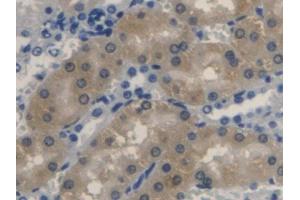 DAB staining on IHC-P; Samples: Rat Kidney Tissue (Biliverdin Reductase Antikörper  (AA 10-279))