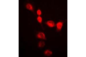 Immunofluorescent analysis of SMUG1 staining in HeLa cells.